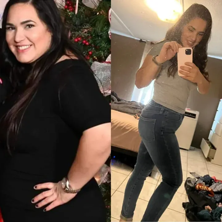 Vanessa — before and after