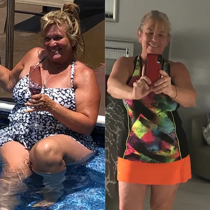 Melinda — before and after